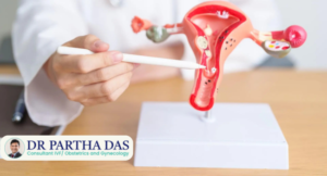 Adenomyosis and pregnancy