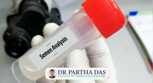 Semen Analysis